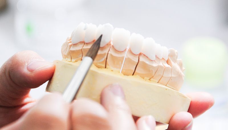 Có nhiều loại răng sứ cercon khác nhau tùy theo nhu cầu của mọi người