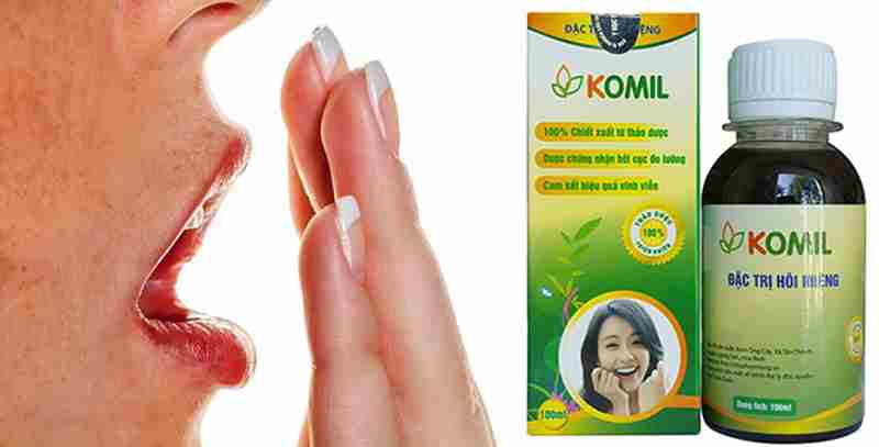 Thuốc trị hôi miệng Komil thường được các bệnh nhân sâu răng sử dụng.