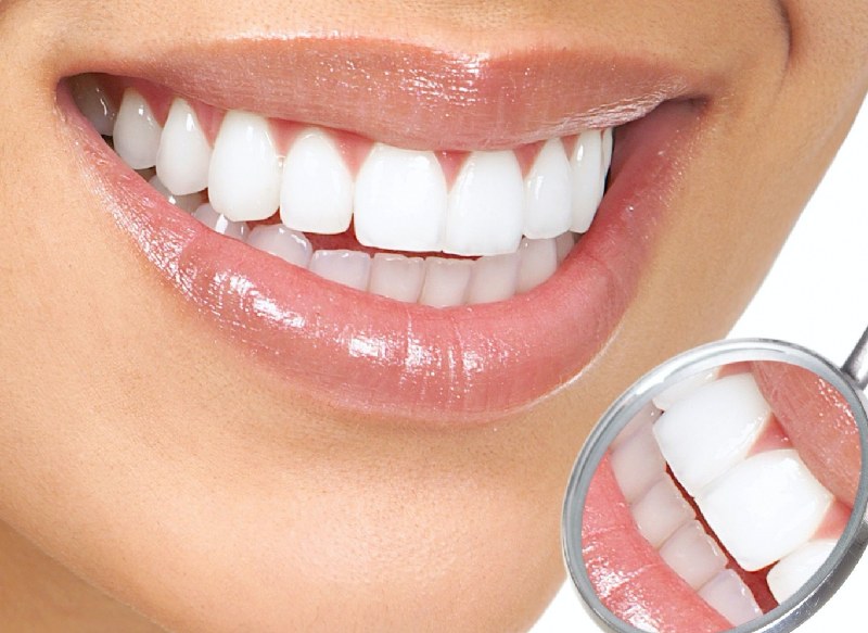 Bọc răng sứ là phương pháp điều trị không gây xâm lấn nên không gây hại cho người bệnh