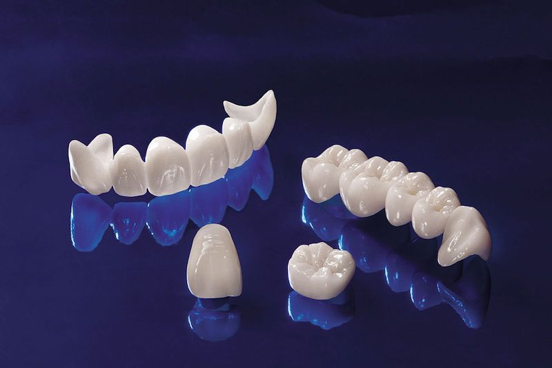 Răng sứ Cercon có màu sắc trắng sáng và có độ trong tự nhiên