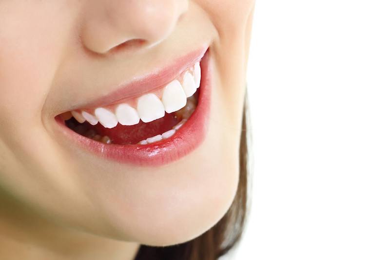 Bọc răng sứ là phương pháp phục hình thẩm mỹ cho răng khá phổ biến