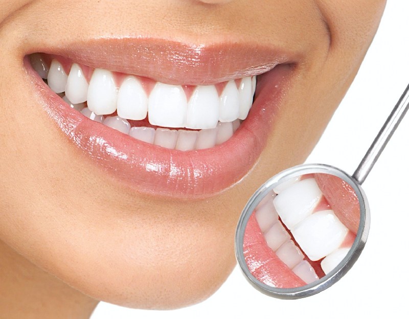 Bọc răng sứ là phương pháp phục hình răng giúp khắc phục các khuyết điểm của hàm răng