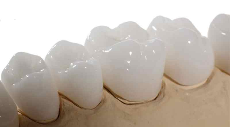 Khả năng phản quang của răng sứ không cao.