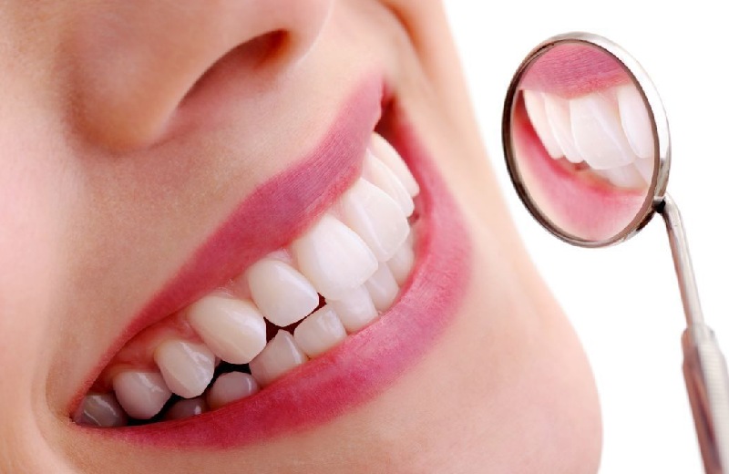 Chọn loại răng sứ phù hợp với nhu cầu và điều kiện tài chính