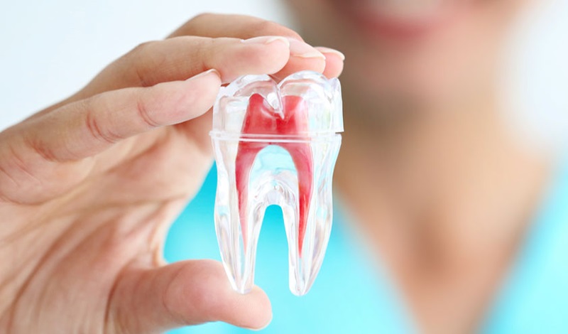 Trám bít ống tủy giúp bảo vệ răng khỏi các kích thích mới