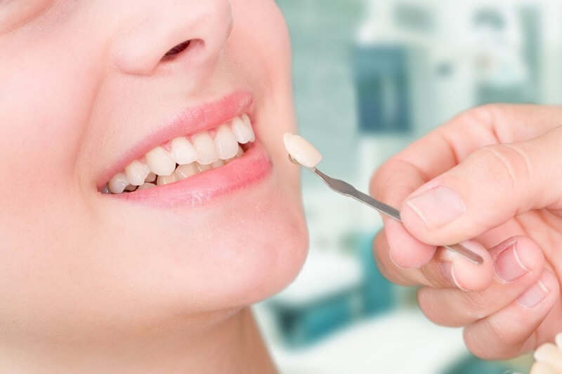 Răng bị lệch khớp cắn không phù hợp để thực hiện bọc răng sứ không mài