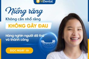 Niềng răng không cần nhổ răng