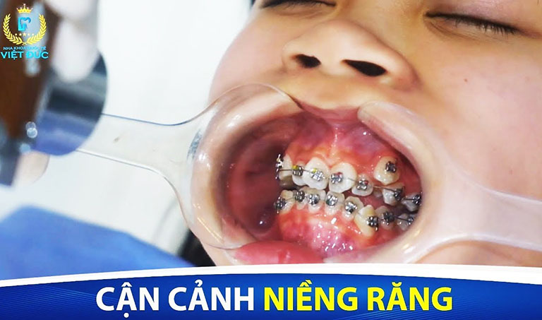 Nha khoa Việt Đức