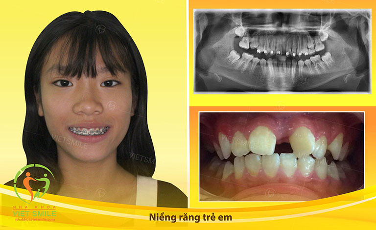 Nha khoa Việt Smile