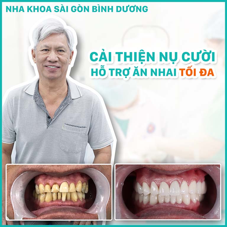 Nha khoa Sài Gòn Bình Dương