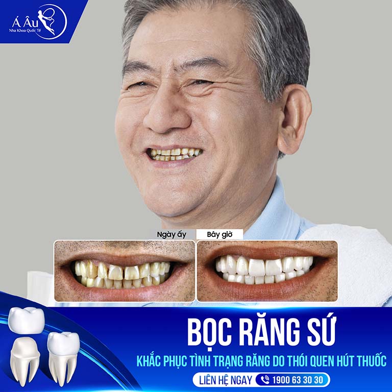 Địa Chỉ Bọc Răng Sứ Quận 1 uy tín