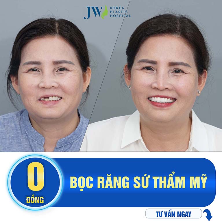 Địa Chỉ Bọc Răng Sứ Quận 1