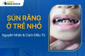 Sún răng là bệnh lý ở đường răng miệng thường gặp ở trẻ nhỏ