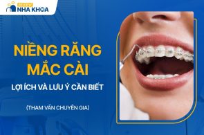 Dịch vụ niềng răng mắc cài