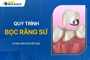 Quy trình bọc răng sứ