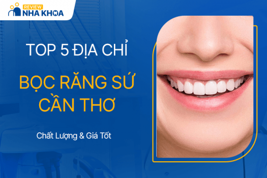 5 Địa Chỉ Bọc Răng Sứ Uy Tín và Tốt Nhất Cần Thơ