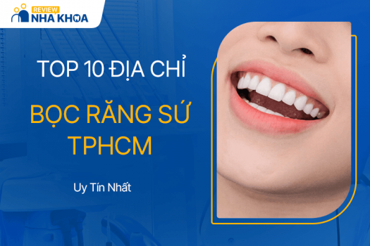 Review 10 Địa Chỉ Bọc Răng Sứ TPHCM Uy Tín Tốt Nhất