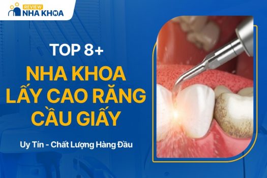 Địa chỉ nha khoa lấy cao răng ở Cầu Giấy