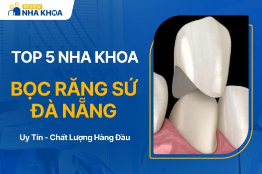 Địa chỉ nha khoa bọc răng sứ Đà Nẵng