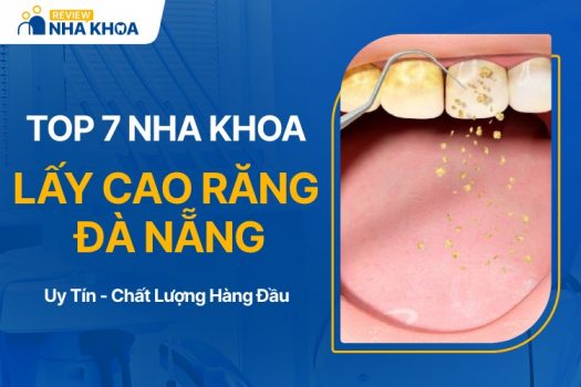 Địa chỉ nha khoa lấy cao răng Đà Nẵng