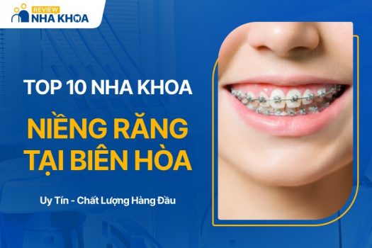 Địa chỉ nha khoa niềng răng biên hòa