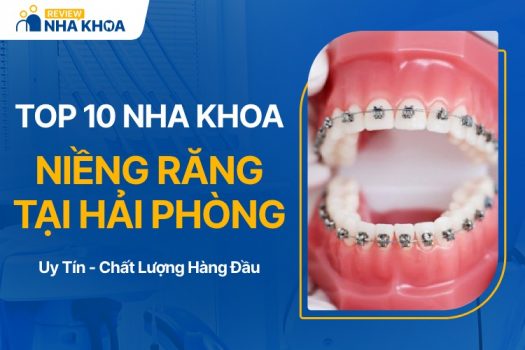 Địa chỉ nha khoa niềng răng Hải Phòng