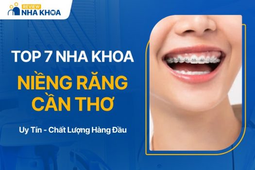 Địa chỉ nha khoa niềng răng tại Cần Thơ