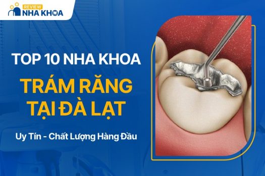 Địa chỉ trám răng uy tín tại Đà Lạt