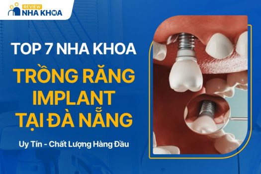 Địa chỉ nha khoa trồng răng Implant tại Đà Nẵng