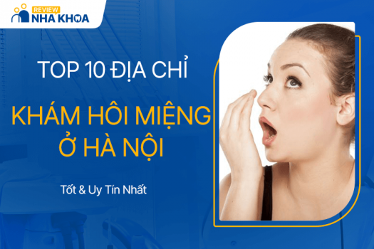 Top 10 Địa Chỉ Khám Hôi Miệng Ở Hà Nội Tốt và Uy Tín Nhất