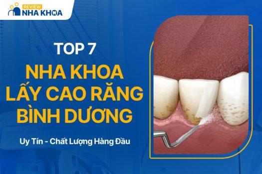 Địa chỉ lấy cao răng ở Bình Dương