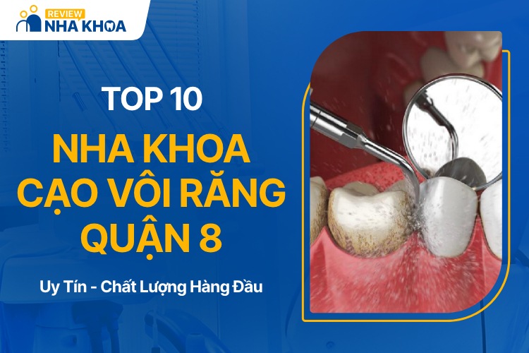 Nha khoa cạo vôi răng quận 8