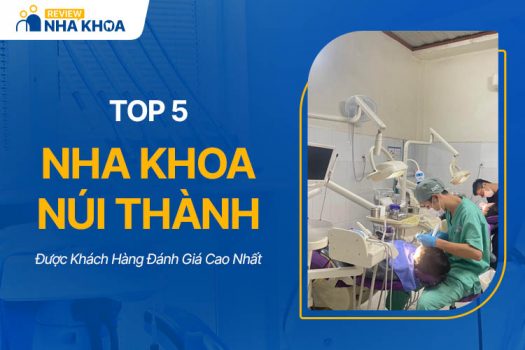 Top 5 Nha Khoa Núi Thành Được Đánh Giá Cao Nhất