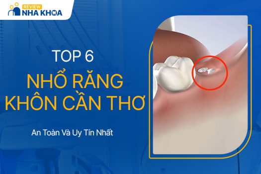 6 Địa Chỉ Nhổ Răng Khôn An Toàn Và Uy Tín Nhất Cần Thơ