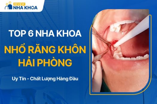 Địa chỉ nhổ răng khôn Hải Phòng uy tín