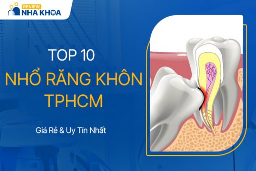 Review 10 Địa Chỉ Nhổ Răng Khôn Uy Tín, Giá Rẻ Ở TPHCM