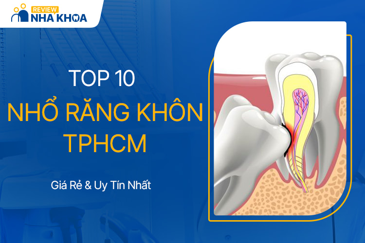 4. Quy trình và kỹ thuật nhổ răng khôn