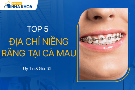 Danh Sách 5 Địa Chỉ Niềng Răng Tại Cà Mau Uy Tín, Giá Tốt