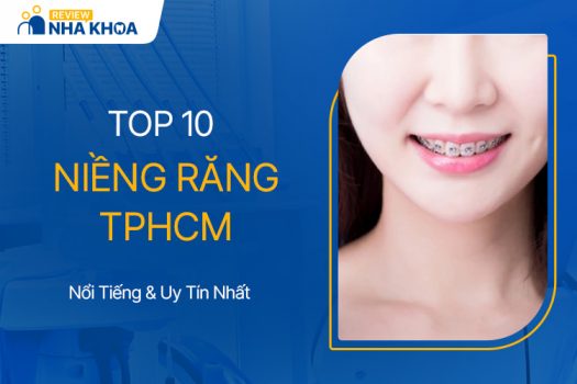 TOP 10 Địa Chỉ Niềng Răng Uy Tín Và Nổi Tiếng Tại TPHCM