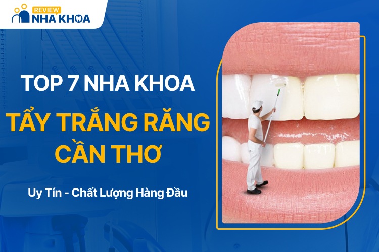 Địa chỉ nha khoa tẩy trắng răng Cần Thơ