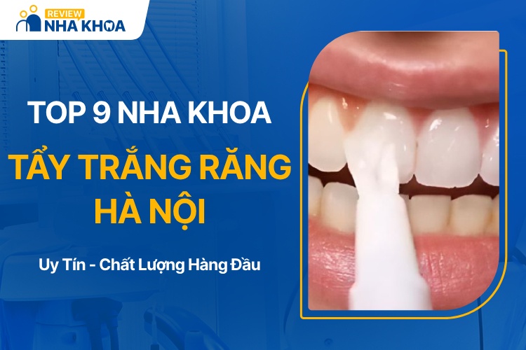 Chi Phí Tẩy Trắng Răng Tại Hà Nội