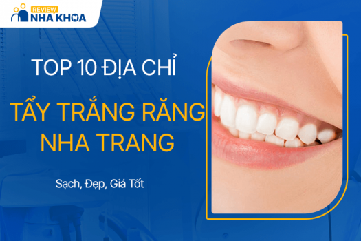 TOP 10 Địa Chỉ Tẩy Trắng Răng Nha Trang Sạch Đẹp, Giá Tốt