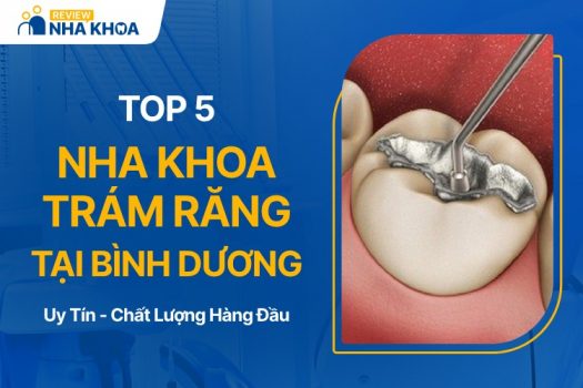 Địa chỉ nha khoa trám răng ở Bình Dương