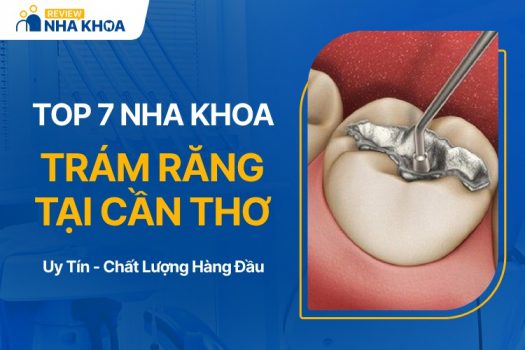 địa chỉ nha khoa trám răng Cần Thơ