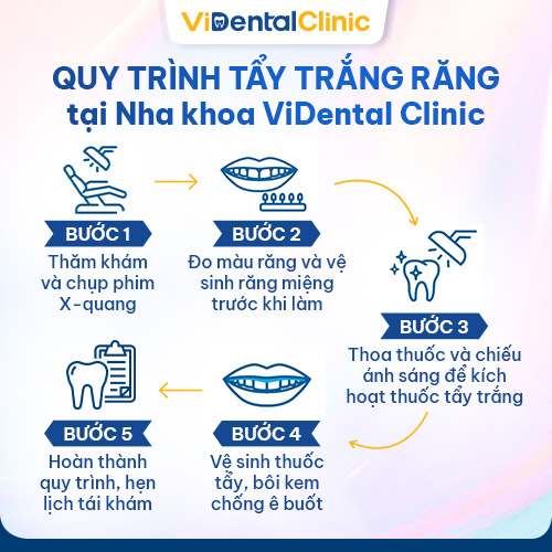 Quy trình tẩy trắng răng bằng công nghệ Prowhite của ViDental Clinic