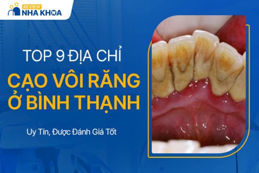 Lưu Ngay 9 Địa Chỉ Cạo Vôi Răng Bình Thạnh Chất Lượng Nhất