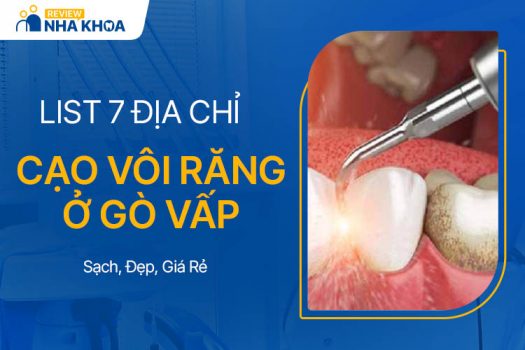 List 7 Địa Chỉ Cạo Vôi Răng Ở Gò Vấp Sạch, Đẹp, Giá Rẻ