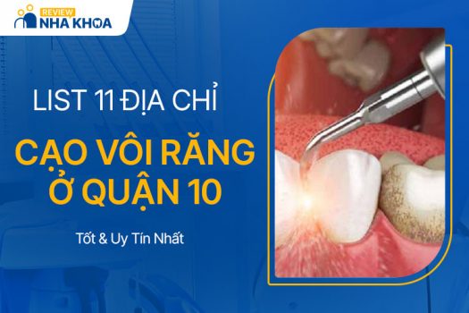 địa chỉ cạo vôi răng ở quận 10