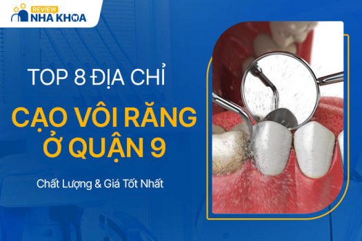 TOP 8 Địa Chỉ Cạo Vôi Răng Quận 9 Chất Lượng, Giá Tốt