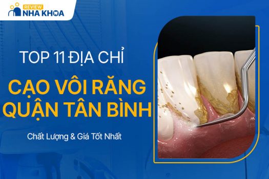 địa chỉ cạo vôi răng Tân Bình